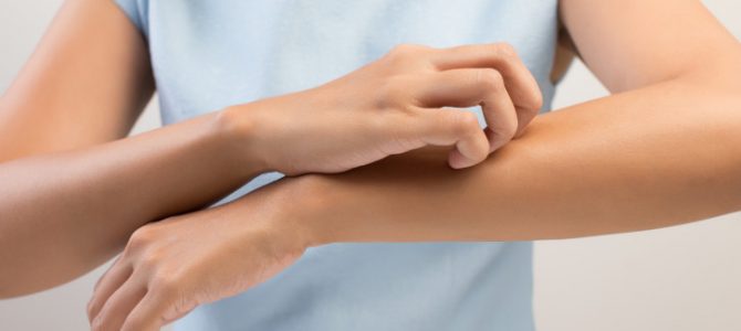 fungal-skin-infections-how-to-treat-them